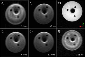 A realistic simulation environment for MRI-based robust control of untethered magnetic robots with intra-operational imaging