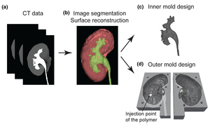 Soft 3D-Printed Phantom of the Human Kidney with Collecting System